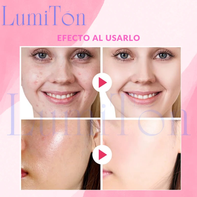 Exfoliantes Faciales LumiTón
