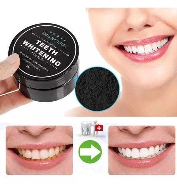 Blanqueador de Dientes con Carbón Activado – Sonrisa Blanca y Natural