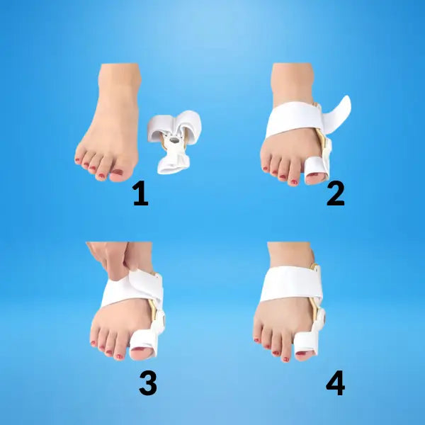 2 Piezas Correctores de Juanetes Hallux Valgus – Separador y Corrector para Dedos